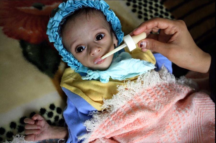 Yémen Arabie Saoudite choléra