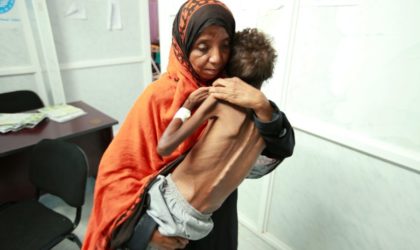 Le choléra tue 2 127 personnes au Yémen