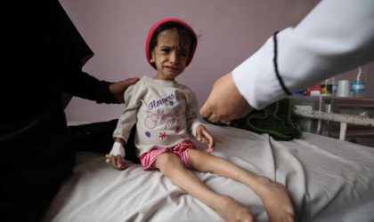Yémen : des enfants touchés par la famine
