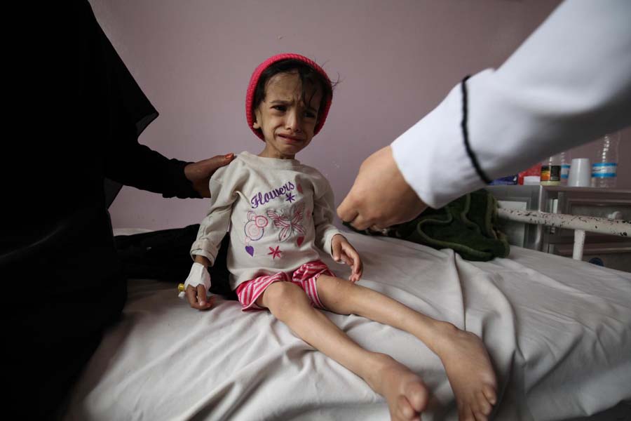 Cappelaere de l’Unicef : «La guerre au Yémen est une guerre contre les enfants»