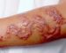 Il a tué 59 personnes en Libye : du henné noir hautement toxique sur le marché