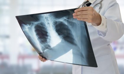 Tuberculose : un nouveau test pourrait sauver des centaines de milliers de personnes