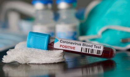 Coronavirus : précautions urgentes à prendre pour les foires internationales