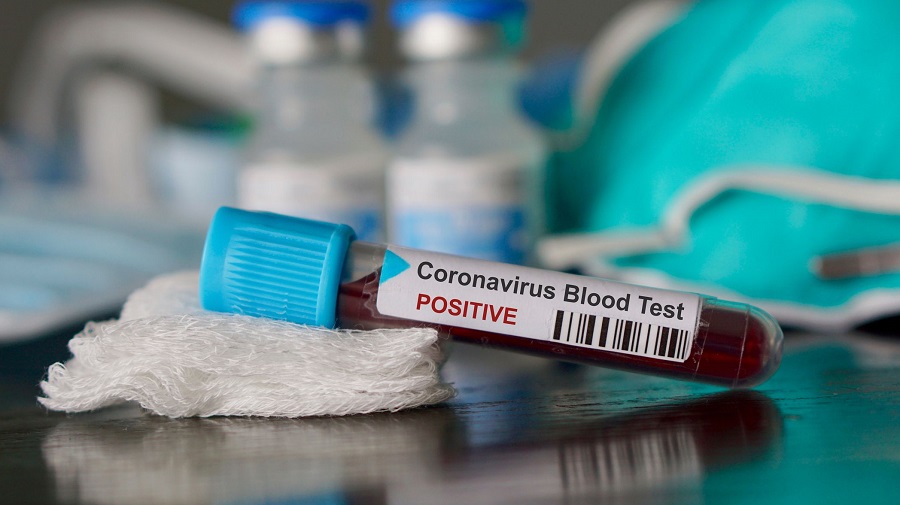 coronavirus foire