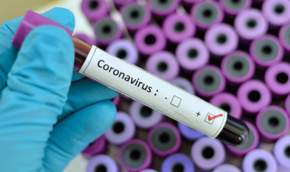 Coronavirus : 2 325 744 décès dans le monde