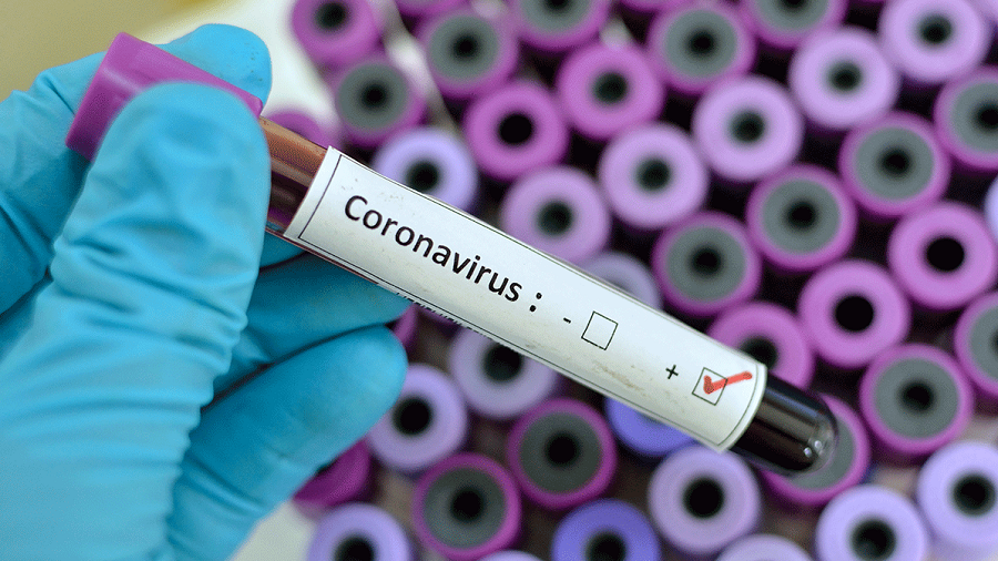 Coronavirus microbe