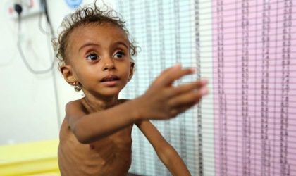 Coronavirus-famine : 11 millions d’enfants de moins de 5 ans en danger